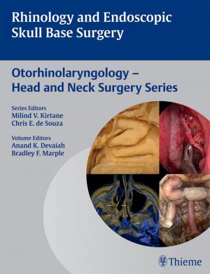 Cover of the book Rhinology and Endoscopic Skull Base Surgery by Eugene Yu, Nasir Jaffer, TaeBong Chung