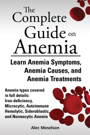 Cover of the book The Complete Guide on Anemia: Learn Anemia Symptoms, Anemia Causes, and Anemia Treatments. Anemia types covered in full details: Iron-deficiency, Microcytic, Autoimmune Hemolytic, Sideroblastic, and Normocytic Anemia by Yogani