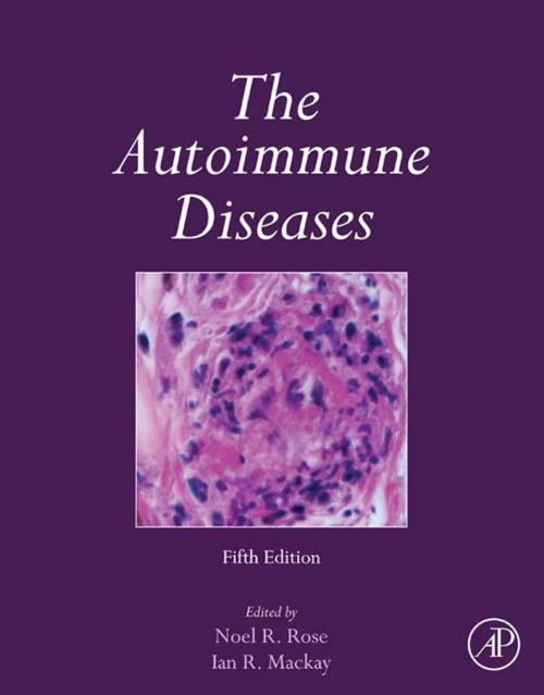 Cover of the book The Autoimmune Diseases by , Elsevier Science