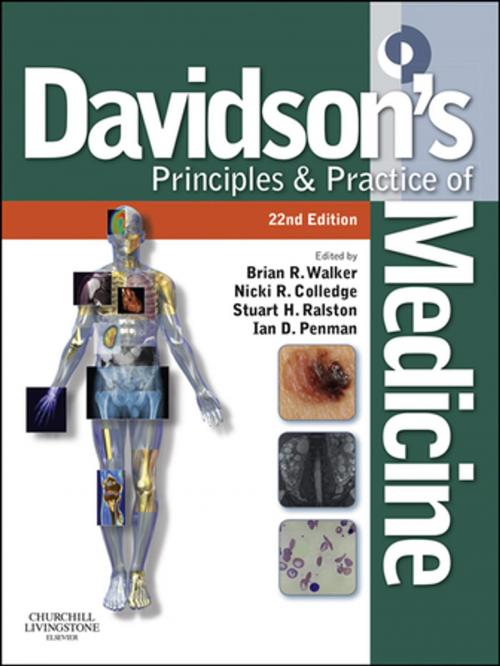 Cover of the book Davidson's Principles and Practice of Medicine E-Book by Nicki R Colledge, BSc (Hons) FRCPE, Brian R. Walker, BSc MB ChB MD FRCPE FRSE FMedSci, Elsevier Health Sciences