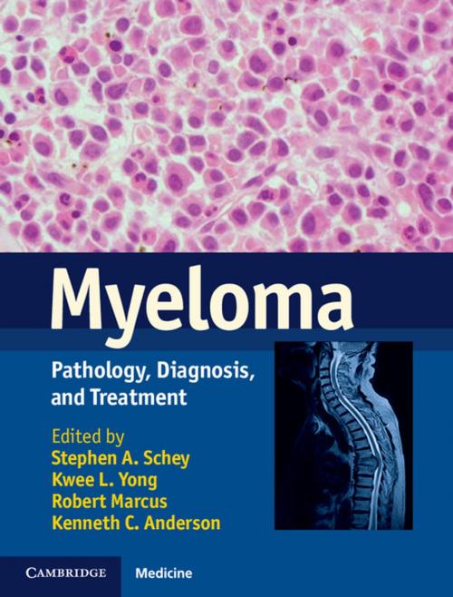 Cover of the book Myeloma by , Cambridge University Press