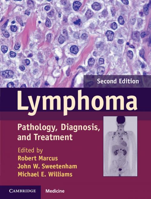 Cover of the book Lymphoma by , Cambridge University Press