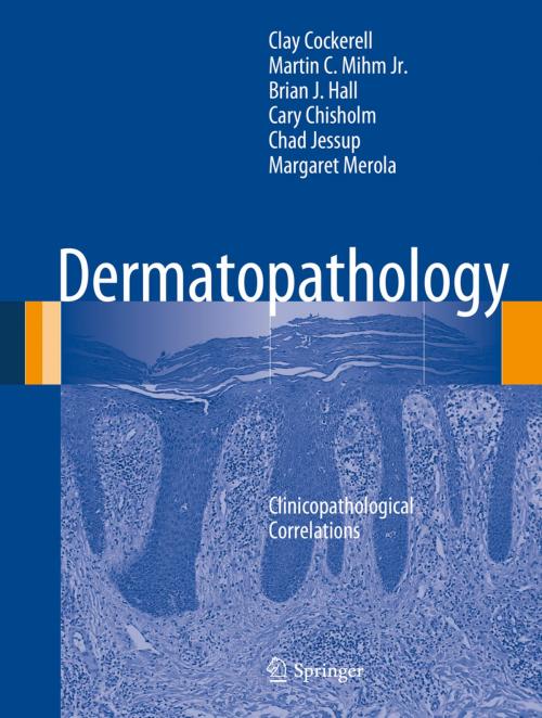 Cover of the book Dermatopathology by Clay Cockerell, Cary Chisholm, Chad Jessup, Martin C. Mihm Jr., Brian J. Hall, Margaret Merola, Springer London