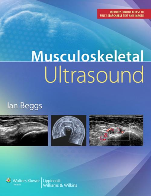 Cover of the book Musculoskeletal Ultrasound by Ian Beggs, Wolters Kluwer Health