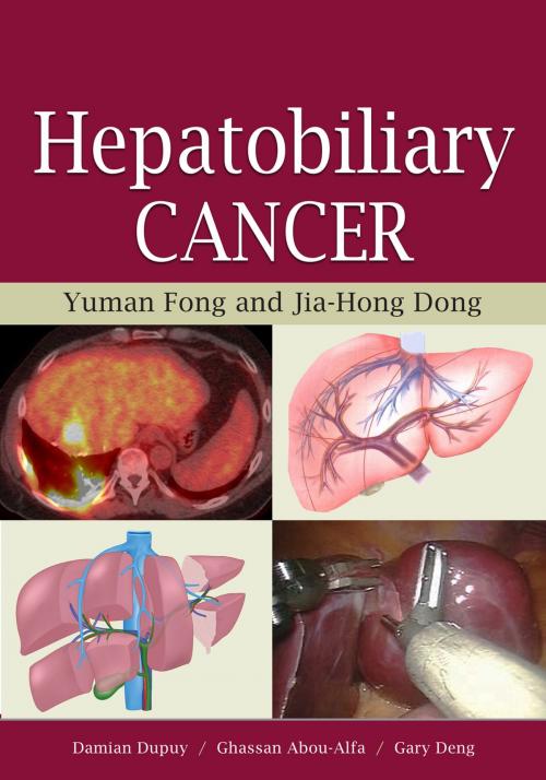Cover of the book Hepatobiliary Cancer by Yuman Fong, PMPH USA, Ltd.