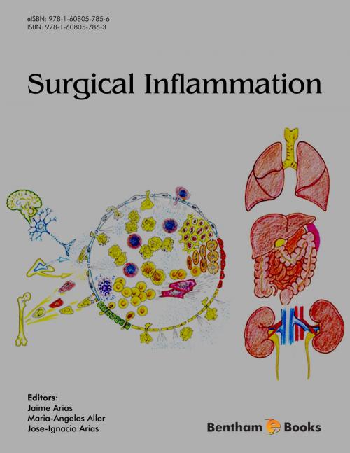 Cover of the book Surgical Inflammation by Jaime  Arias, Jaime  Arias, Maria-Angeles  Aller, Jose-Ignacio  Arias, Bentham Science Publishers
