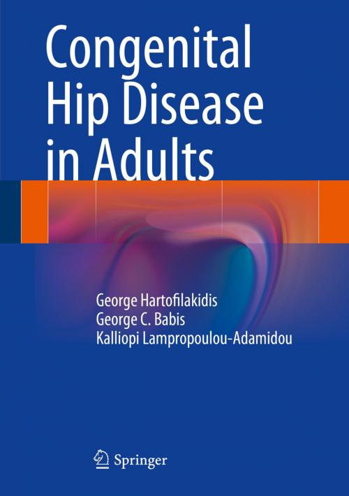 Cover of the book Congenital Hip Disease in Adults by George C. Babis, George Hartofilakidis, Kalliopi Lampropoulou-Adamidou, Springer Milan