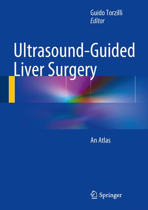 Cover of the book Ultrasound-Guided Liver Surgery by , Springer Milan