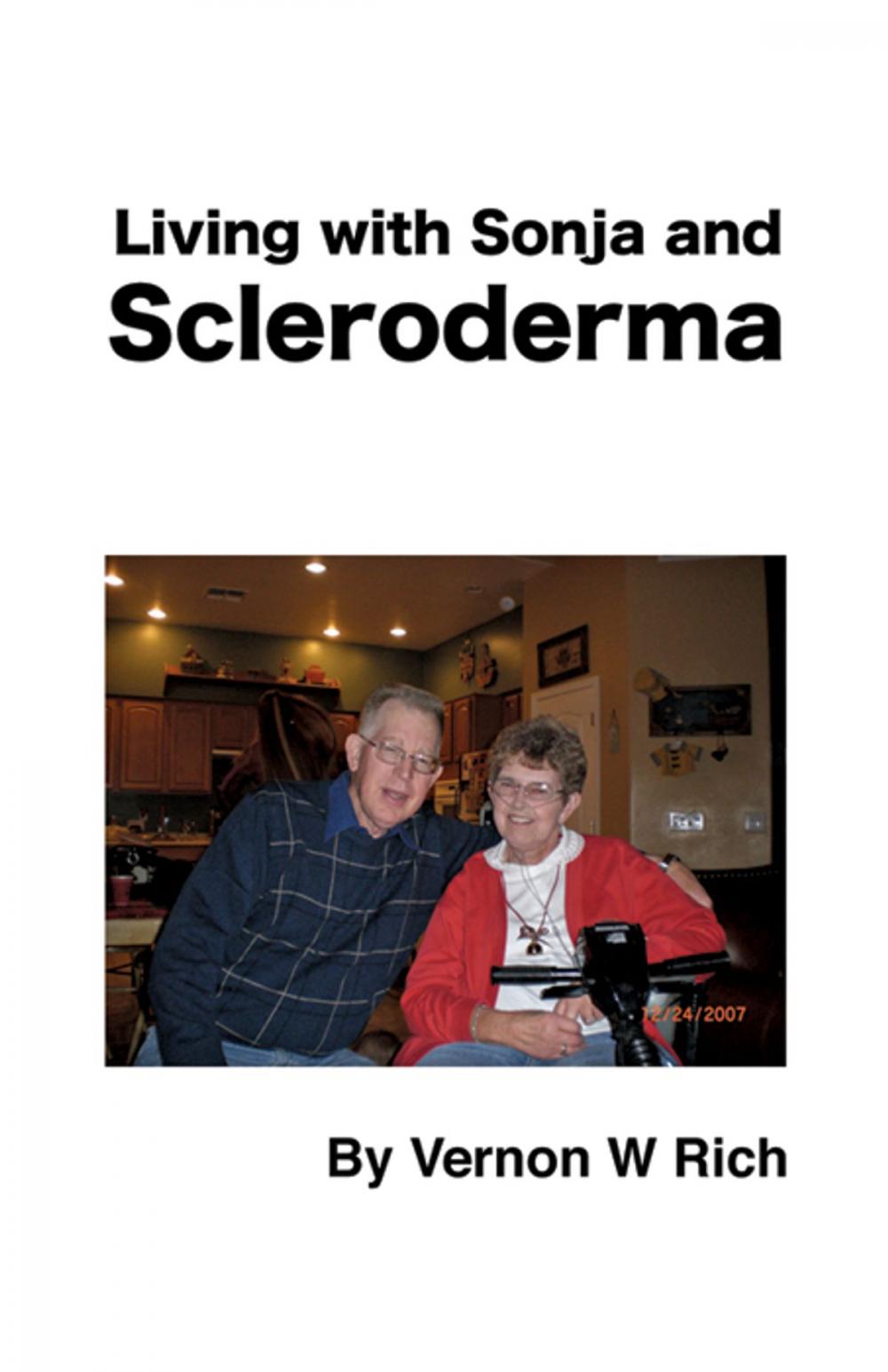 Big bigCover of Living with Sonja and Schleroderma