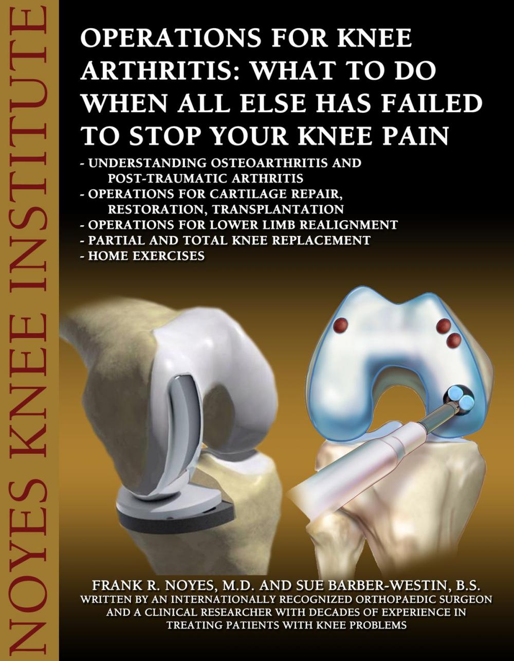 Big bigCover of Operations for Knee Arthritis: What To Do When All Else Has Failed To Stop Your Knee Pain