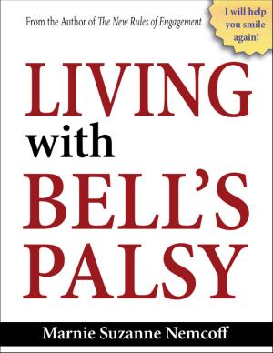 Cover of Living with Bells Palsy