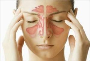 Book cover of Acute Sinusitis: Causes, Symptoms and Treatments