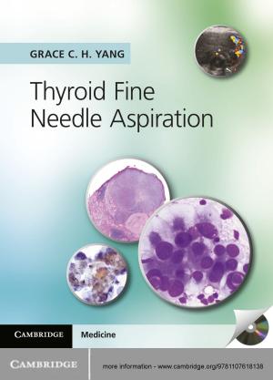Cover of the book Thyroid Fine Needle Aspiration by Jacqueline Peel, Hari M. Osofsky