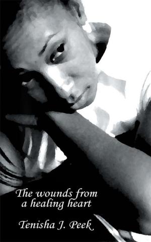 Cover of the book The Wounds from a Healing Heart by Lucille Anderson