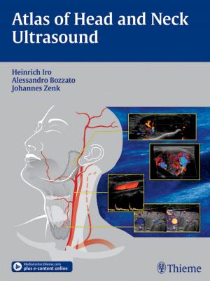 Book cover of Atlas of Head and Neck Ultrasound