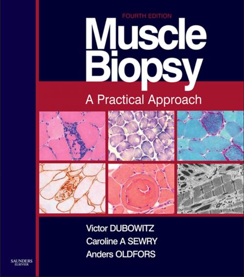 Cover of the book Muscle Biopsy E-Book by Victor Dubowitz, MD, PhD, FRCP, FRCPCH, Anders Oldfors, MD PhD, Caroline A. Sewry, BSc, PhD, FRCPath, Elsevier Health Sciences