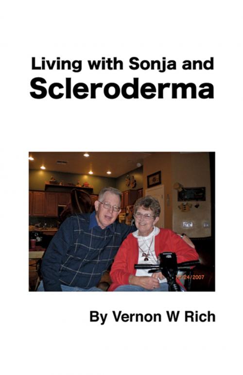 Cover of the book Living with Sonja and Schleroderma by Vernon W. Rich, Infinity Publishing