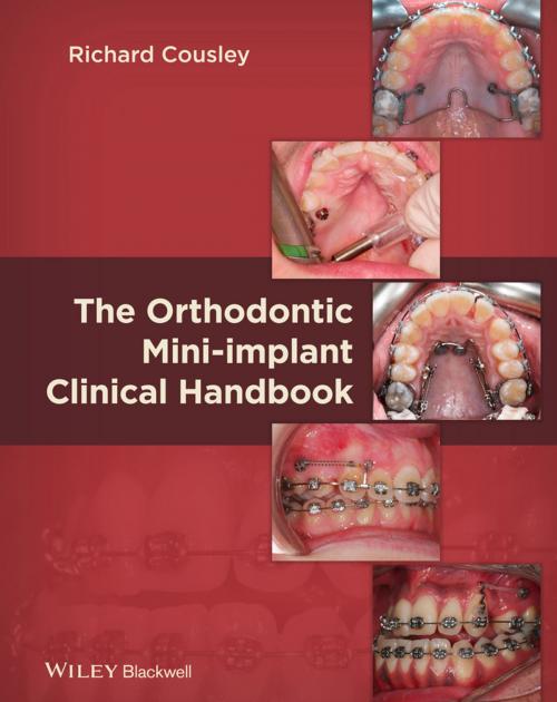 Cover of the book The Orthodontic Mini-implant Clinical Handbook by Richard Cousley, Wiley