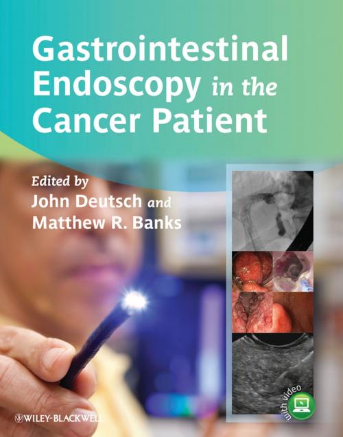 Cover of the book Gastrointestinal Endoscopy in the Cancer Patient by , Wiley