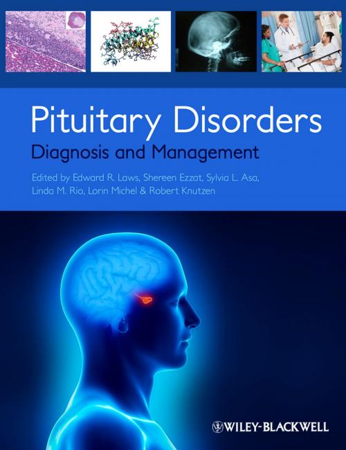 Cover of the book Pituitary Disorders by , Wiley