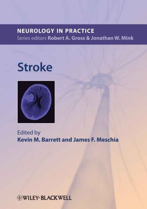 Cover of the book Stroke by , Wiley