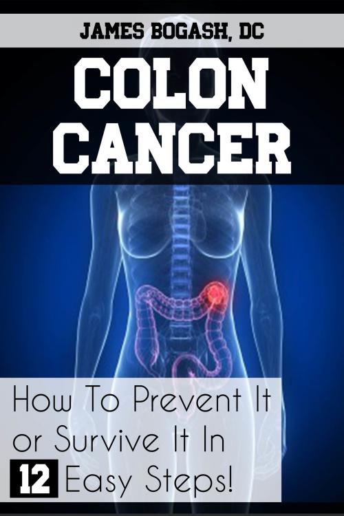 Cover of the book Colon Cancer: How to Prevent it or Survive it in 12 Easy Steps by James Bogash, DC, James Bogash, DC