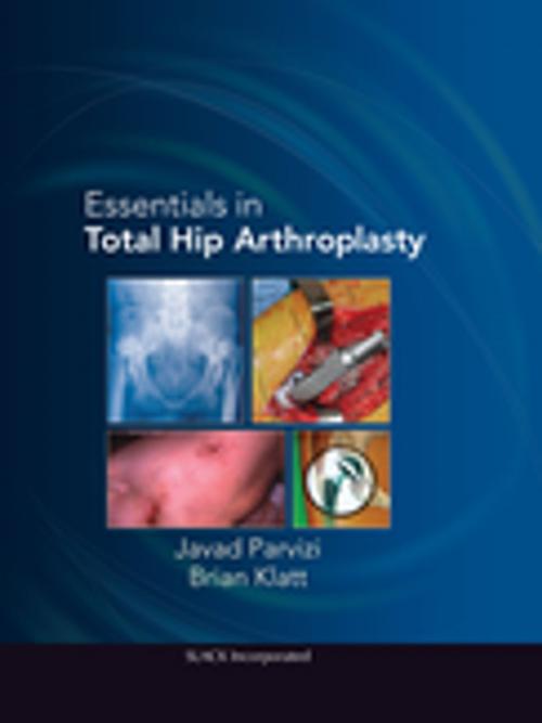Cover of the book Essentials in Total Hip Arthroplasty by , SLACK Incorporated