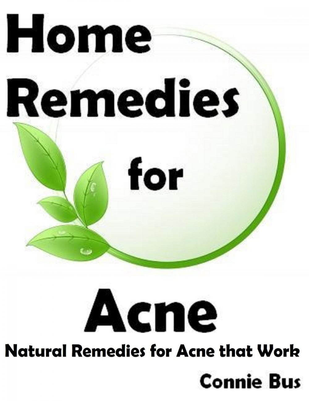Big bigCover of Home Remedies for Acne: Natural Remedies for Acne that Work