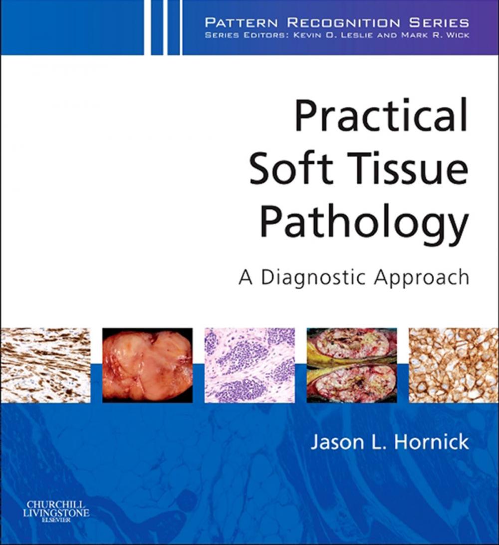 Big bigCover of Practical Soft Tissue Pathology: A Diagnostic Approach E-Book