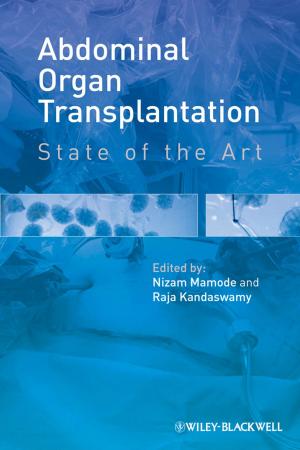 Cover of the book Abdominal Organ Transplantation by Roger Kinsky
