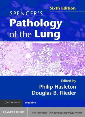 Cover of the book Spencer's Pathology of the Lung by Jakob de de Haan, Sander Oosterloo, Dirk Schoenmaker