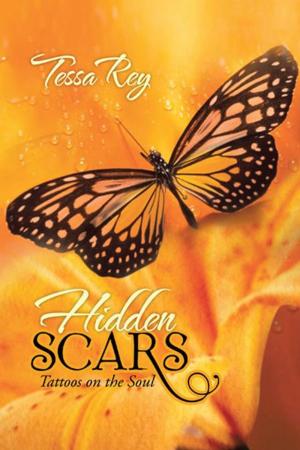 Cover of the book Hidden Scars by Ysatis De Saint-Simon