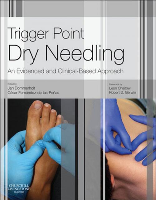Cover of the book Trigger Point Dry Needling E-Book by Jan Dommerholt, PT, DPT, MPS, Cesar Fernandez de las Penas, PT, PhD, Dr. SciMed, Elsevier Health Sciences