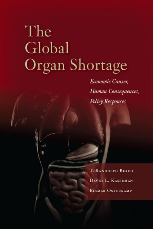 Cover of the book The Global Organ Shortage by T. Randolph Beard, David L. Kaserman, Rigmar Osterkamp, Stanford University Press