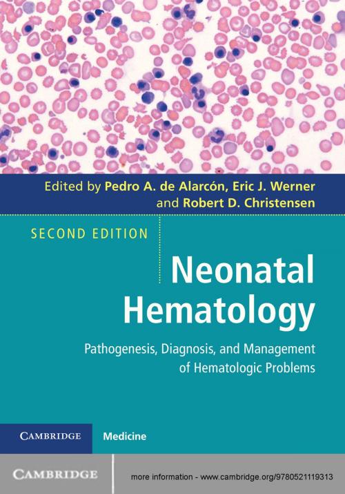 Cover of the book Neonatal Hematology by , Cambridge University Press