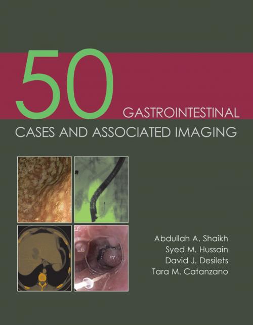 Cover of the book 50 Gastrointestinal Cases and Associated Imaging by Abdullah A Shaikh, tfm Publishing Ltd