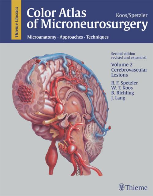 Cover of the book Color Atlas of Microneurosurgery, Volume 2: Cerebrovascular Lesions by Robert F. Spetzler, Wolfgang T. Koos, B. Richling, Thieme