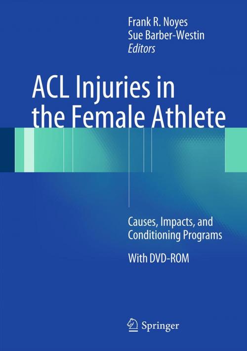 Cover of the book ACL Injuries in the Female Athlete by , Springer Berlin Heidelberg