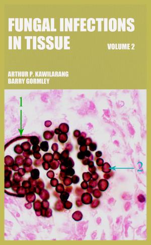 bigCover of the book Fungal Infections in Tissue Volume 2 by 