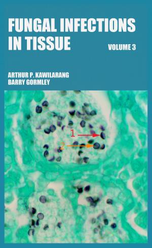 Book cover of Fungal Infections in Tissue Volume 3