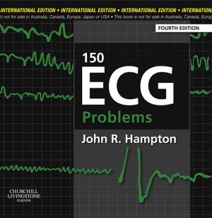 Book cover of 150 ECG Problems E-Book