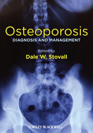 Cover of the book Osteoporosis by Muralisrinivasan Natamai Subramanian