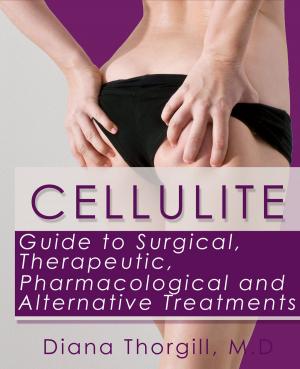 Cover of the book Cellulite: Guide to Surgical, Therapeutic, Pharmacological and Alternative Treatments by Diana Thorgill