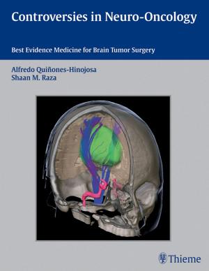 bigCover of the book Controversies in Neuro-Oncology by 