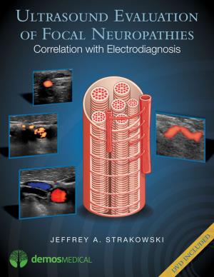 Cover of the book Ultrasound Evaluation of Focal Neuropathies by Toni C. Antonucci, PhD, PhD Harvey Sterns, PhD, James Jackson, PhD