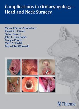 Cover of the book Complications in Otolaryngology-Head and Neck Surgery by Andrew Blitzer, Mitchell F. Brin, Lorraine Olson Ramig