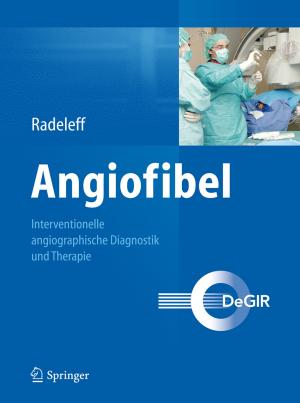 bigCover of the book Angiofibel by 