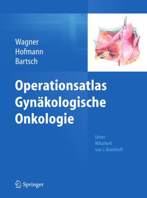 Cover of the book Operationsatlas Gynäkologische Onkologie by 