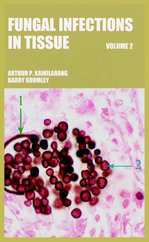Cover of the book Fungal Infections in Tissue Volume 2 by Arthur Pohan Kawilarang, Barry Gormley, Arthur Pohan Kawilarang