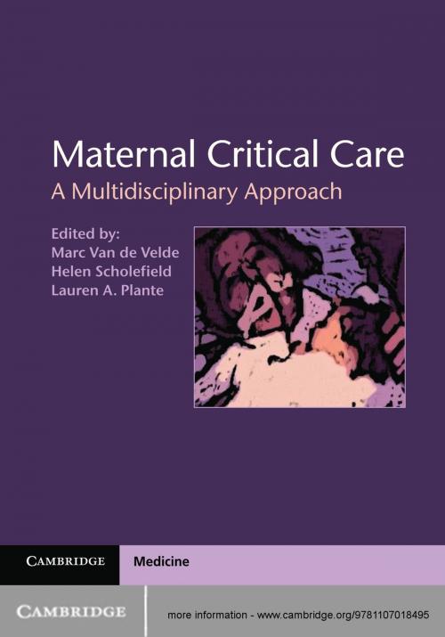 Cover of the book Maternal Critical Care by , Cambridge University Press